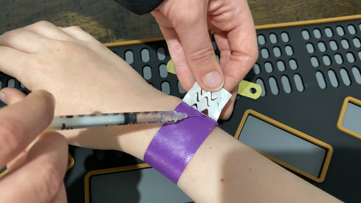 injecting shellite under the sticky part of a wristband using a syringe